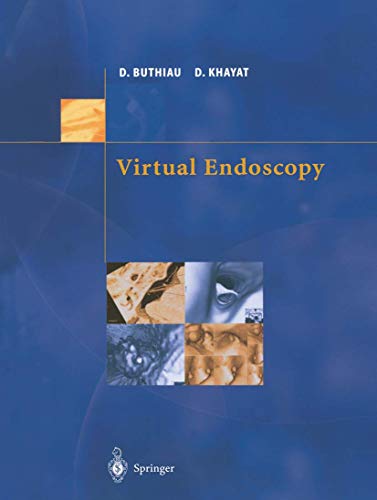 medical/gastroenterology/virtual-endoscopy-9782287596582