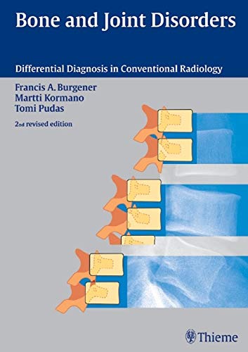 BONE AND JOINT DISORDERS