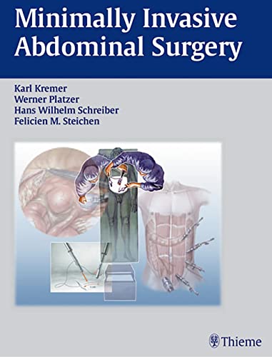 technical/general/minimally-invasive-abdominal-surgery-9783131081919