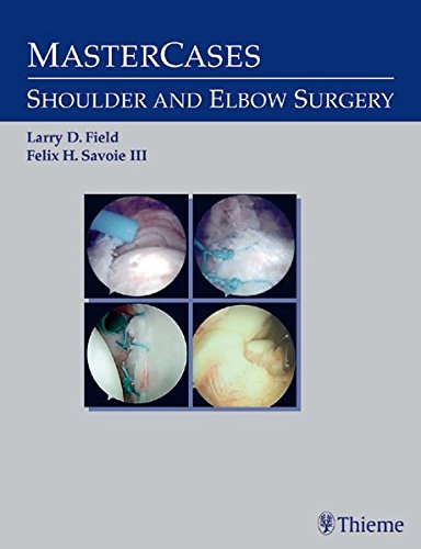 medical/orthopaedics/mastercases-shoulder-and-elbow-surgery-1-ed-9783131085917