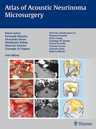 exclusive/neurology/atlas-of-acoustic-neurinoma-microsurgery-9783131102829