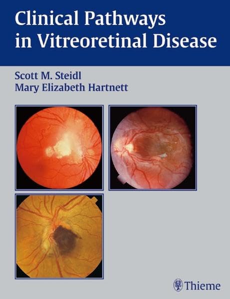medical/ophthalmology/clinical-pathways-in-vitreoretinal-disease-9783131258113