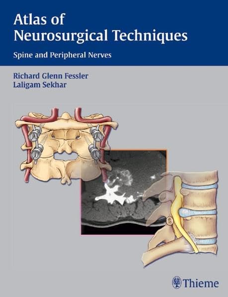 medical/neurology/atlas-of-n-osurgical-techniques-9783131275318