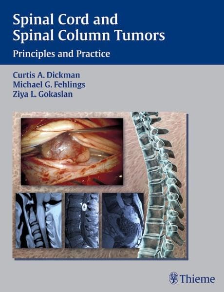 medical/neurology/spinal-cord-and-spinal-column-tumors-principles-and-practice-9783131307712