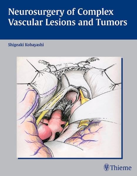 medical/neurology/neurosurgery-of-complex-vascular-lesions-and-tumors-9783131320513
