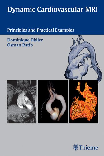medical/cardiac-surgery/dynamic-cardiovascular-mri-principles-and-practical-examples-9783131330413