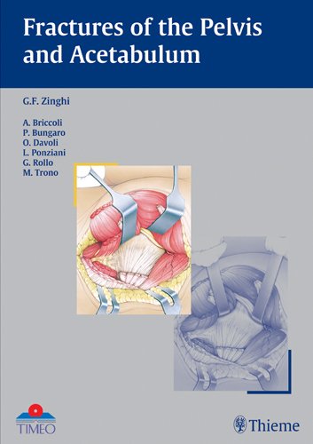 technical/general/fractures-of-the-pelvis-and-acetabulum-1-ed-9783131363817