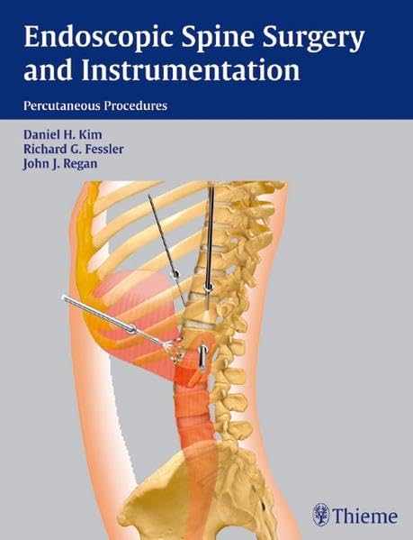 medical/surgery/endoscopic-spine-surgery-and-instrumentation-9783131366511
