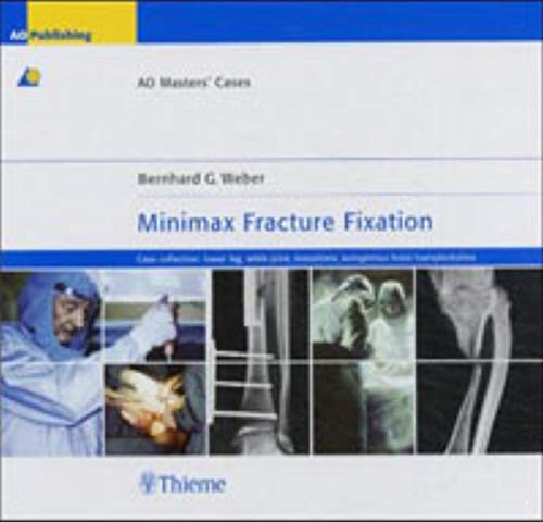 medical/orthopaedics/minimax-fracture-fixation-case-collection-lower-leg-ankle-ao-master-cases-9783131392718