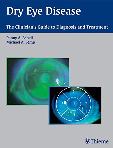 medical/ophthalmology/dry-eye-disease-the-clinician-s-guide-to-diagnosis-and-treatment-9783131397713
