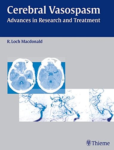 medical/psm/cerebral-vasopasm-advances-in-research-and-treatment-1-ed-9783131400611