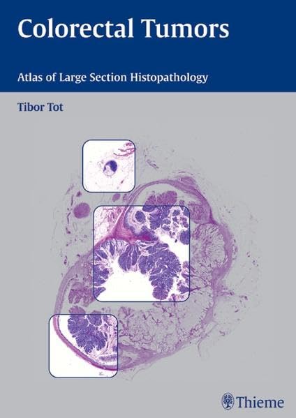 COLORECTAL TUMORS: ATLAS OF LARGE SECTION HISTOPATHOLOGY