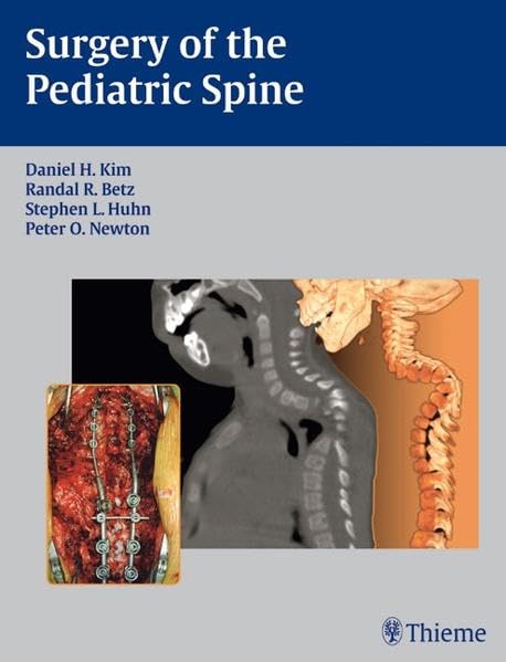 medical/neurology/surgery-of-the-pediatric-spine-9783131419316