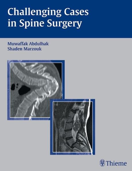 medical/neurology/challenging-cases-in-spine-surgery-9783131419415