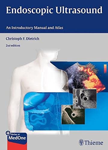 ENDOSCOPIC ULTRASOUND: AN INTRODUCTORY MANUAL AND ATLAS medical/radiology/endoscopic-ultrasound-an-introductory-manual-and-atlas-9783131431523