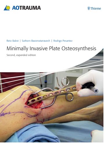 technical/general/minimally-invasive-plate-osteosynthesis-mipo--9783131433923