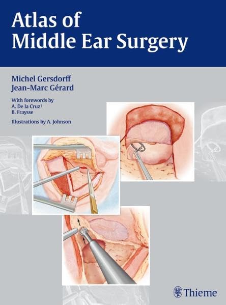 ATLAS OF MIDDLE EAR SURGERY (EXCL. ABC)