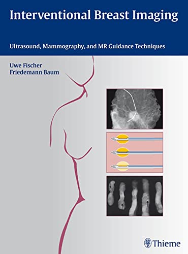 INTERVENTIONAL BREAST IMAGING