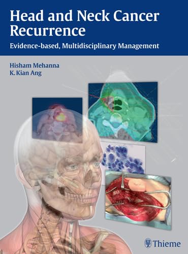 exclusive/oncology/head-and-neck-cancer-recurrence-evidence-based-mul-9783131473912