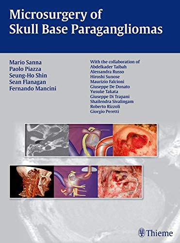 medical/otolaryngology/microsurgery-of-skull-base-paragangliomas-1-e-9783131486110