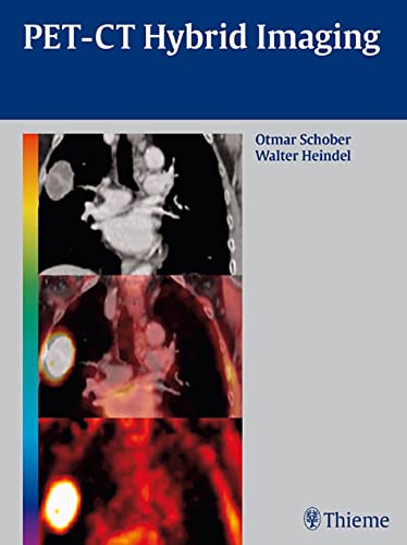 PET-CT HYBRID IMAGING: