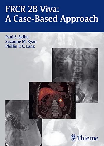 FRCR 2B VIVA A CASE-BASED APPROACH