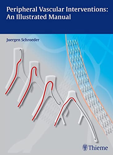 medical/cardiac-surgery/peripheral-vascular-interventions-an-illustrated-manual--9783131697516