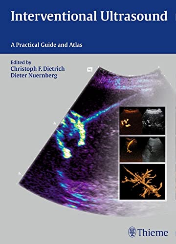 INTERVENTIONAL ULTRASOUND