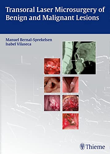 medical/otolaryngology/transoral-laser-microsurgery-of-benign-and-malignant-lesions-9783131723918
