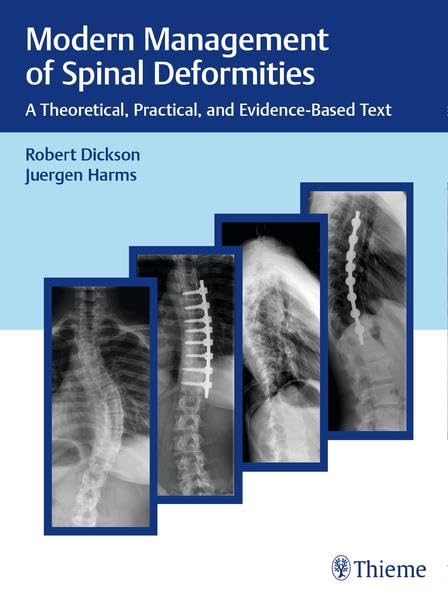 exclusive/neurology/modern-management-of-spinal-deformities-a-theoretical-practical-and-evidence-based-text-9783132016316