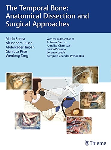 medical/otolaryngology/the-temporal-bone-anatomical-dissection-and-surgical-approaches-1-e-9783132419346