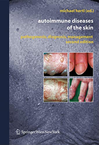 medical/dermatology/autoimmune-diseases-of-the-skin-pathogenesis-diagnosis-management-2-e-9783211206867