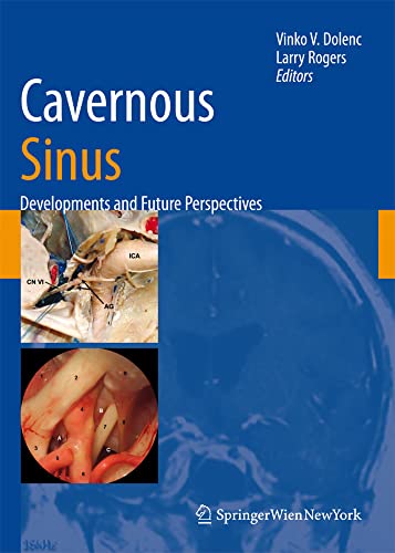 technical/general/cavernous-sinus-developments-and-future-perspective-9783211721377