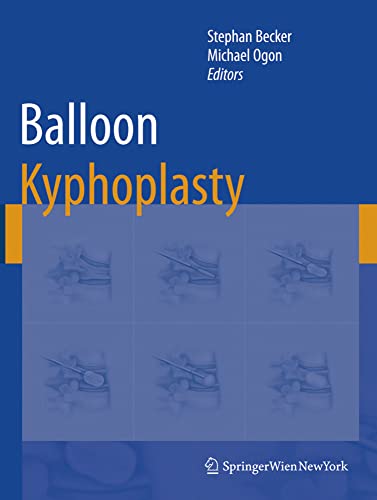 medical/ophthalmology/balloon-kyphoplasty-9783211742204