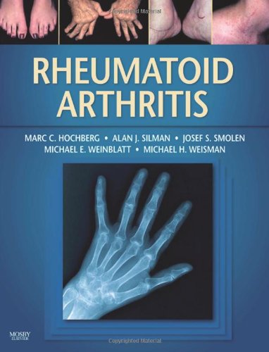 medical/orthopaedics/rheumatoid-arthritis-9780323054751