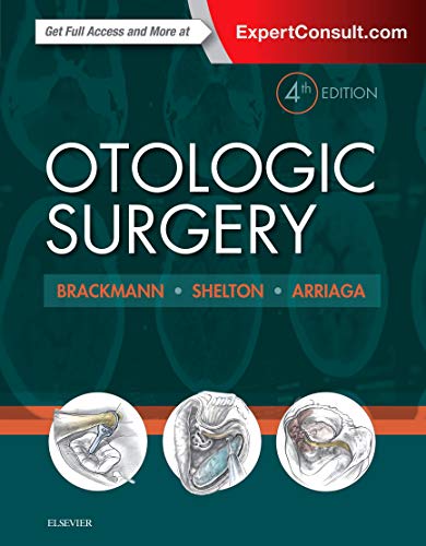 medical/otolaryngology/otologic-surgery-4e-9780323299770