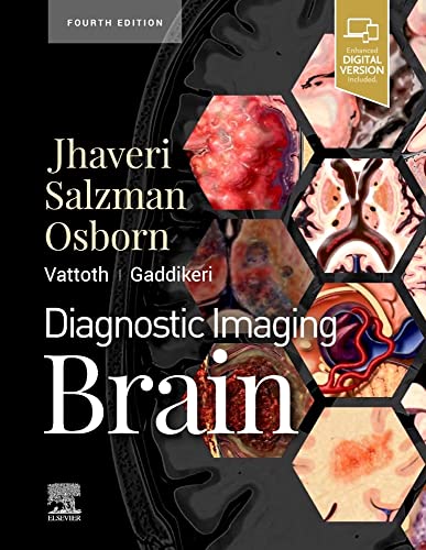 DIAGNOSTIC IMAGING: BRAIN, 4E medical/radiology/diagnostic-imaging-brain-4e-9780323756204