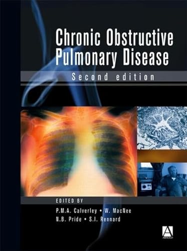 medical/respiratory-medicine/chronic-obstructive-pulmonary-disease-2ed-excl-abc--9780340807187