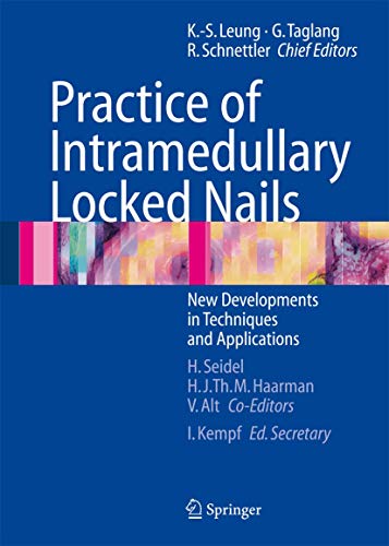 medical/physiotherapy/practice-of-intramedullary-locked-nails--9783540253495