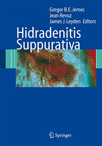 medical/cardiology/hidradenitis-suppurativa-9783540331001