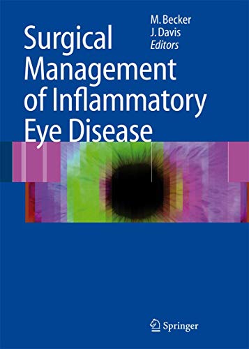 medical/ophthalmology/surgical-management-of-inflammatory-eye-disease-9783540338611