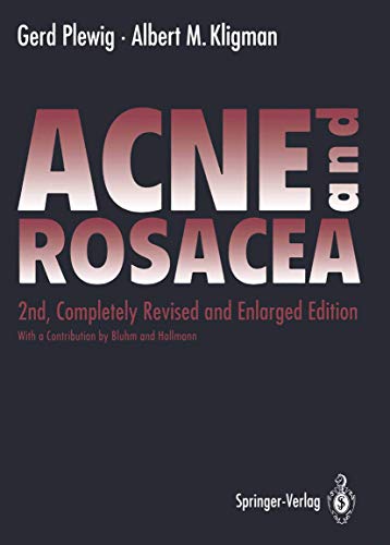 medical/pathology/acne-and-rosacea-9783540522775