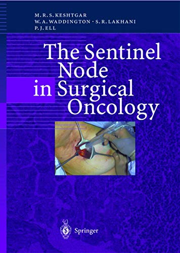medical/oncology/the-sentinel-node-in-surgical-oncology-9783540651765