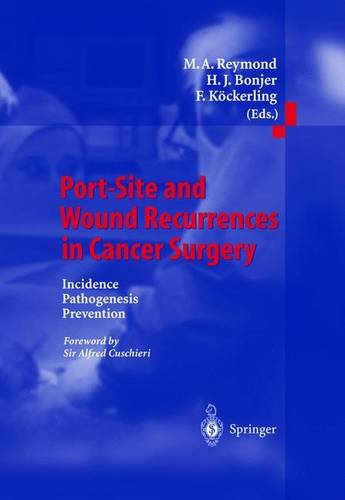 medical/oncology/port-site-and-wound-recurrences-in-cancer-surgery-9783540669296