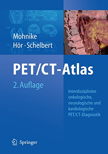 medical/cardiology/oncologic-and-cardiologic-pet-ct-diagnosis-9783540740902