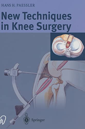 medical/surgery/new-techniques-in-knee-surgery-9783798513877