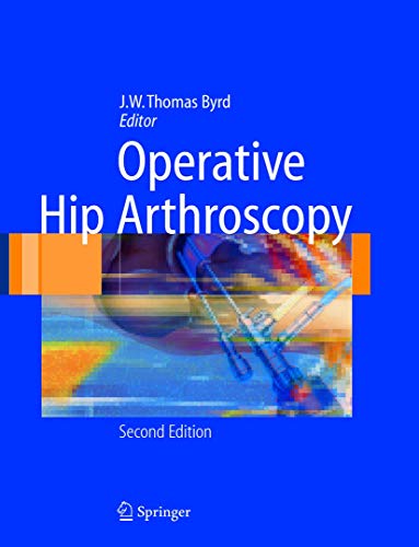 medical/orthopaedics/operative-hip-arthroscopy-9780387210117