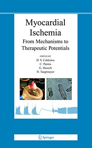 MYOCARDIAL ISCHEMIA FROM MECHANISMS TO THERAPEUTIC POTENTIALS medical/cardiology/myocardial-ischemia-from-mechanisms-to-therapeutic-potentials-9780387286570