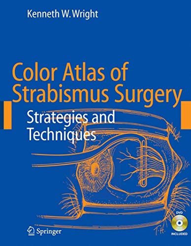 medical/ophthalmology/color-atlas-of-strabismus-surgery-strategies-and-techniques-dvd-included-9780387332499