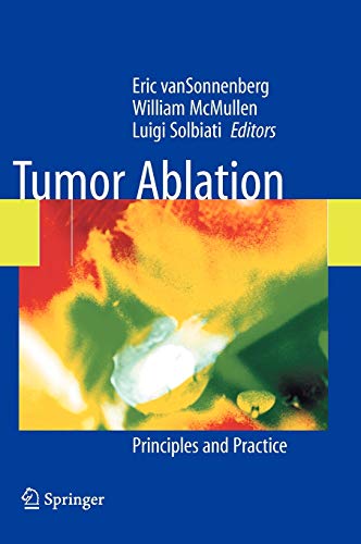 medical/oncology/tumor-ablation-principles-and-practice-9780387955391